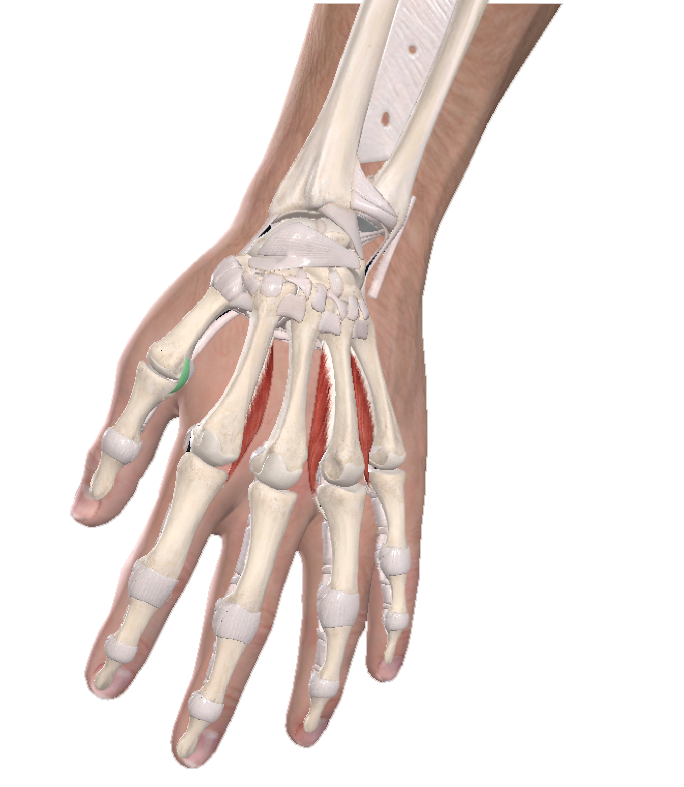 Skier Thumb The causes, symptoms and treatments Orthopaedics Corner